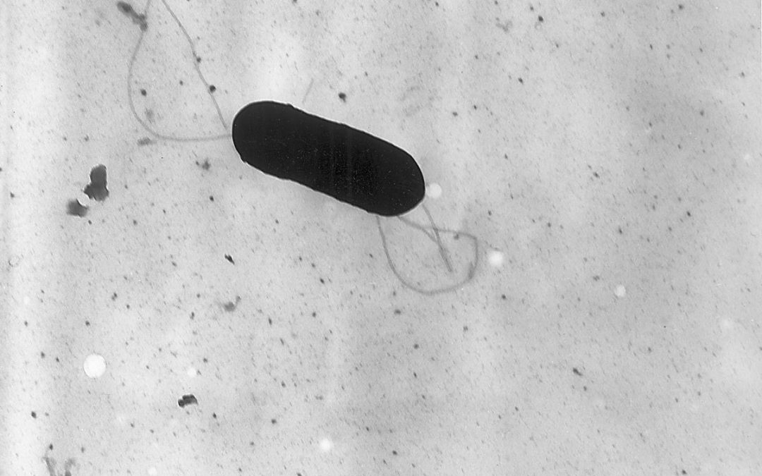 La Listeriosis: Un Riesgo Latente en Alimentos Listos para el Consumo